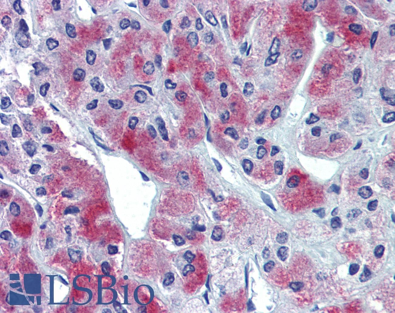 IHC-plus™ Polyclonal Rabbit anti-Human GLE1 Antibody (IHC, IF, WB)