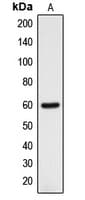 DCLRE1B Antibody (C-Terminus)