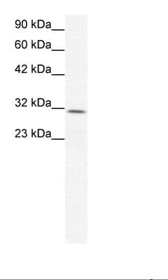 CLDN17 / Claudin 17 Antibody (aa103-152)