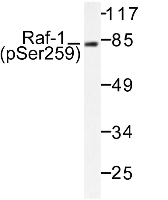Polyclonal Rabbit anti-Human RAF1 / RAF Antibody (phospho-Ser259, IHC, WB)