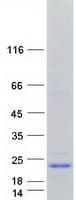 Human C2orf52 Protein (Recombinant Myc-DDK (Flag))
