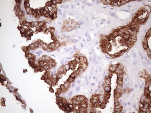 KRT16 / CK16 / Cytokeratin 16 Antibody (clone 7A4, Carrier-free)