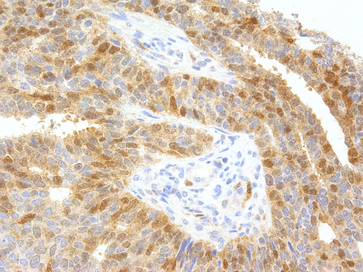 thyA / Thymidylate Synthetase Antibody (clone IHC697, Concentrated)