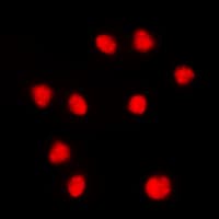FOXC1+2 Antibody (Internal)