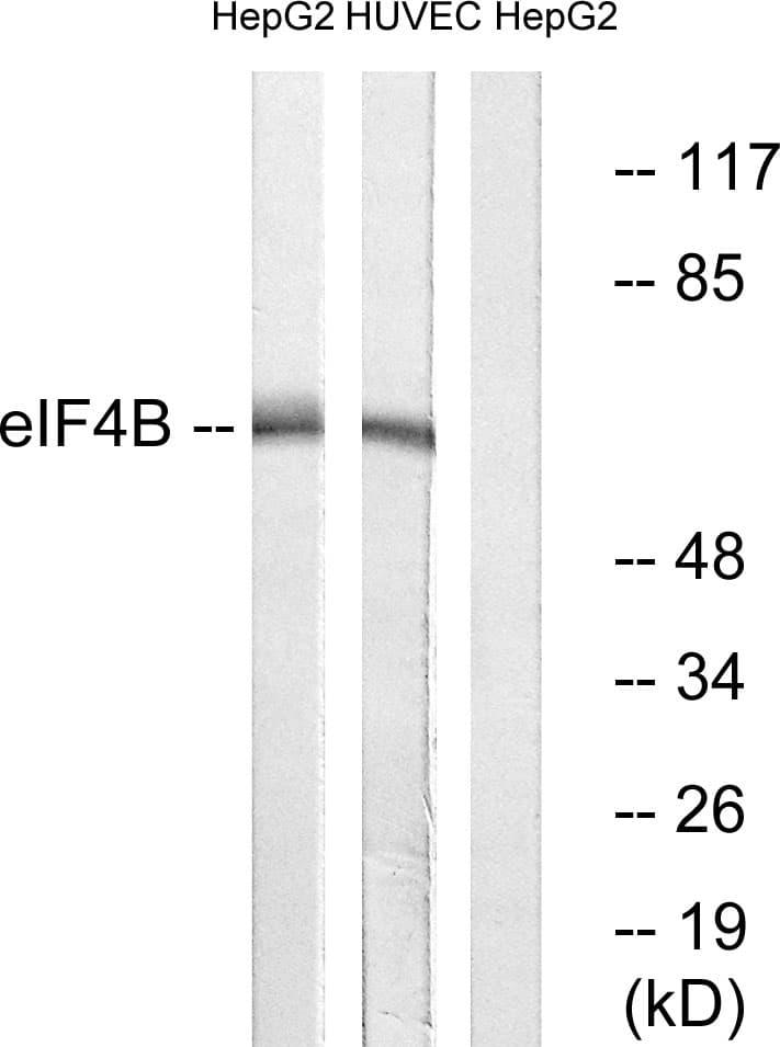 Polyclonal Rabbit anti-Human EIF4B Antibody (aa388-437, IHC, IF, WB)