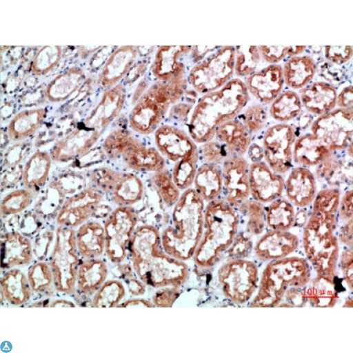 PRF1 / Perforin Antibody