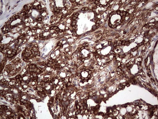 PKM2 Antibody (clone 12B9)