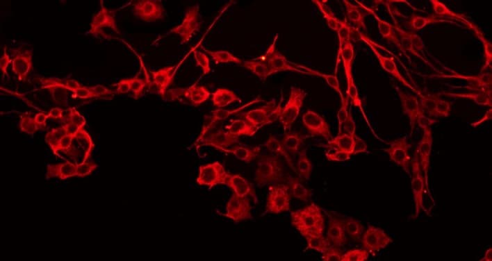 MMP15 Antibody