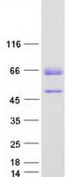 Human TOX2 Protein (Recombinant Myc-DDK (Flag))