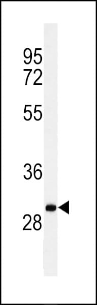 C19orf18 Antibody (aa140-168)