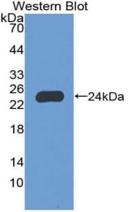 NCF2 / NOXA2 / p67phox Antibody (aa355-526)