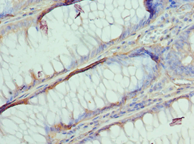 AP2B1 Antibody (aa738-937)