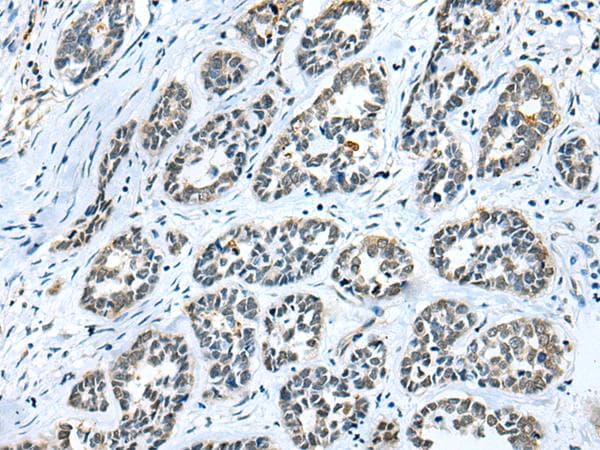 GMF Beta / GMFB Antibody