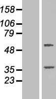 TTC23 Protein (Over-Expression Lysate Myc-DDK (Flag))