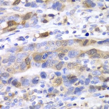 UBCH10 / UBE2C Antibody