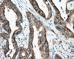 DNTTIP1 / TDIF1 Antibody (clone OTI1E2)