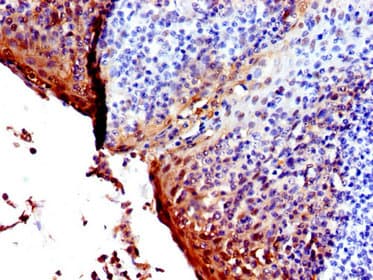 SFN / Stratifin / 14-3-3 Sigma Antibody