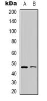 IHC-plus™ Polyclonal Rabbit anti-Human WWOX Antibody (N-Terminus, IHC, WB)