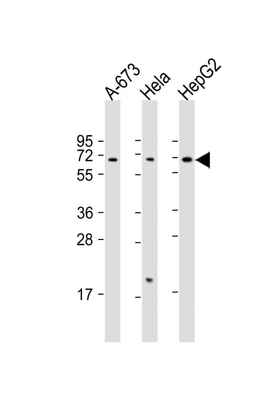Polyclonal Rabbit anti-Human CHRNA4 / NACHR Antibody (aa472-503, WB)