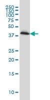IHC-plus™ PLEK / Pleckstrin Antibody (clone 6E3)