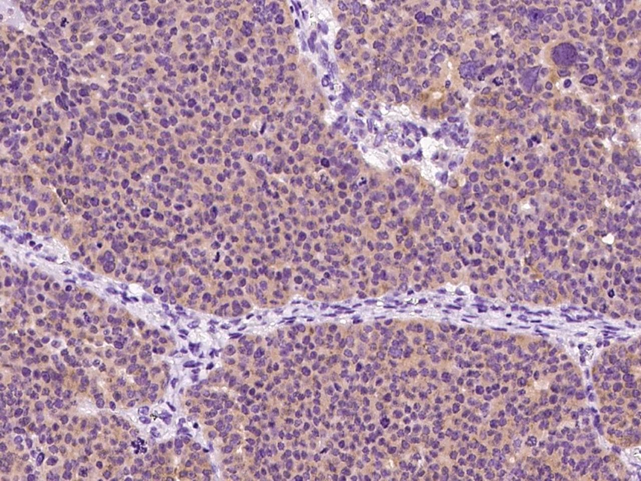 Polyclonal Rabbit anti-Human CYPOR / POR Antibody (IHC, WB)