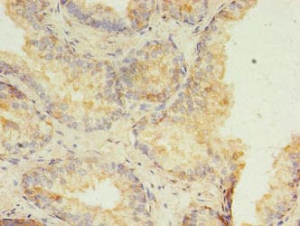 HMGN3 Antibody
