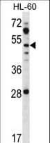 Polyclonal Rabbit anti-Human ZIC / ZIC1 Antibody (aa6-34, WB)