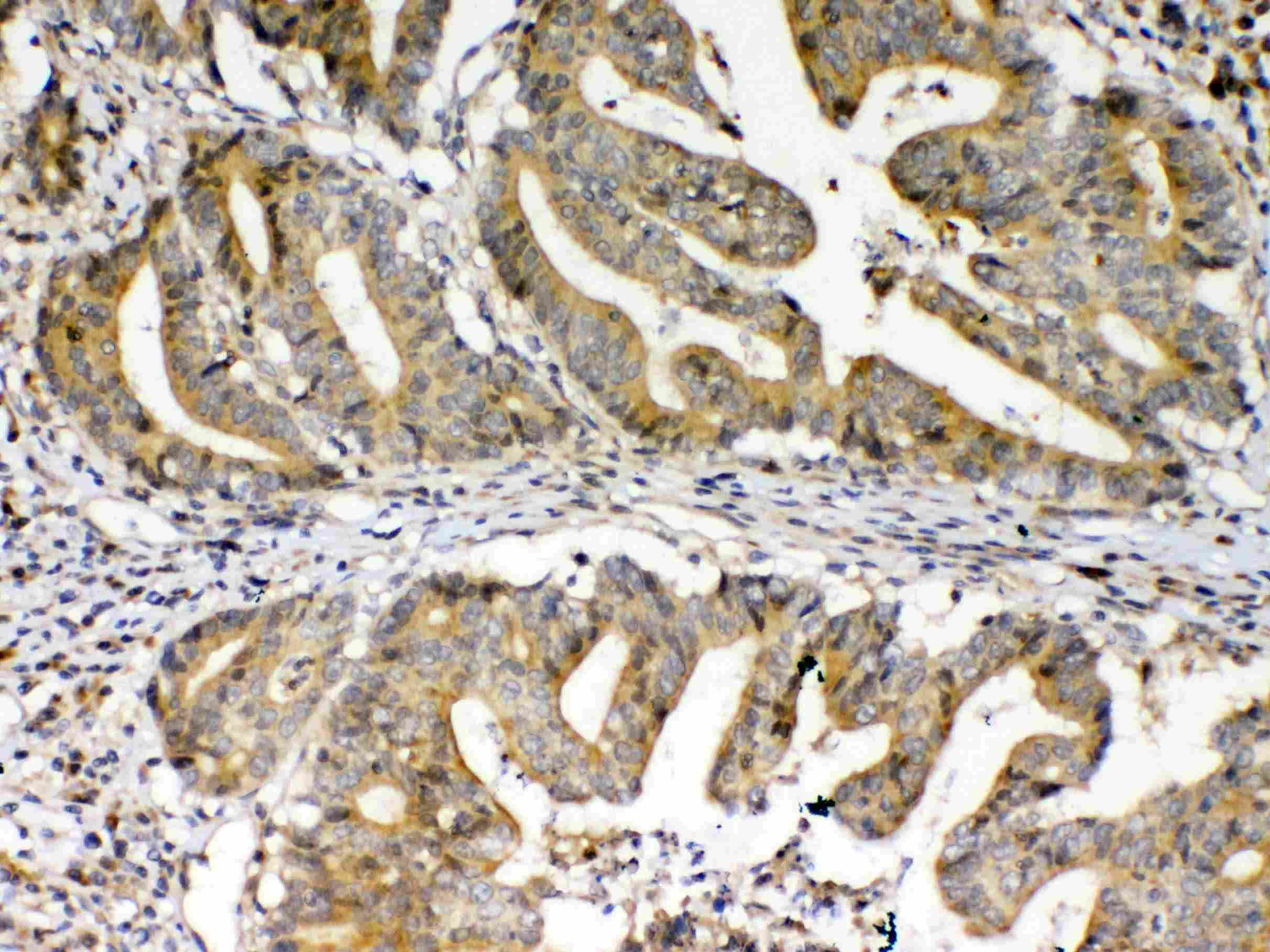 Polyclonal Rabbit anti-Human FZD3 / Frizzled 3 Antibody (IHC, WB)
