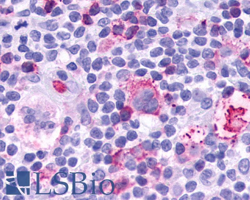 PathPlus™ Leukotriene B4 Receptor / BLT1 Antibody (C-Terminus)