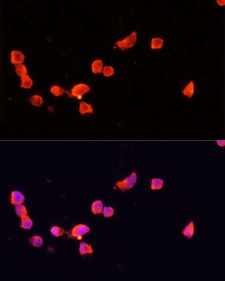 Polyclonal Rabbit anti-Human CDK5R1 Antibody (IF)