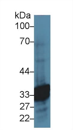 CA6 / Carbonic Anhydrase 6 Antibody (aa147-275)