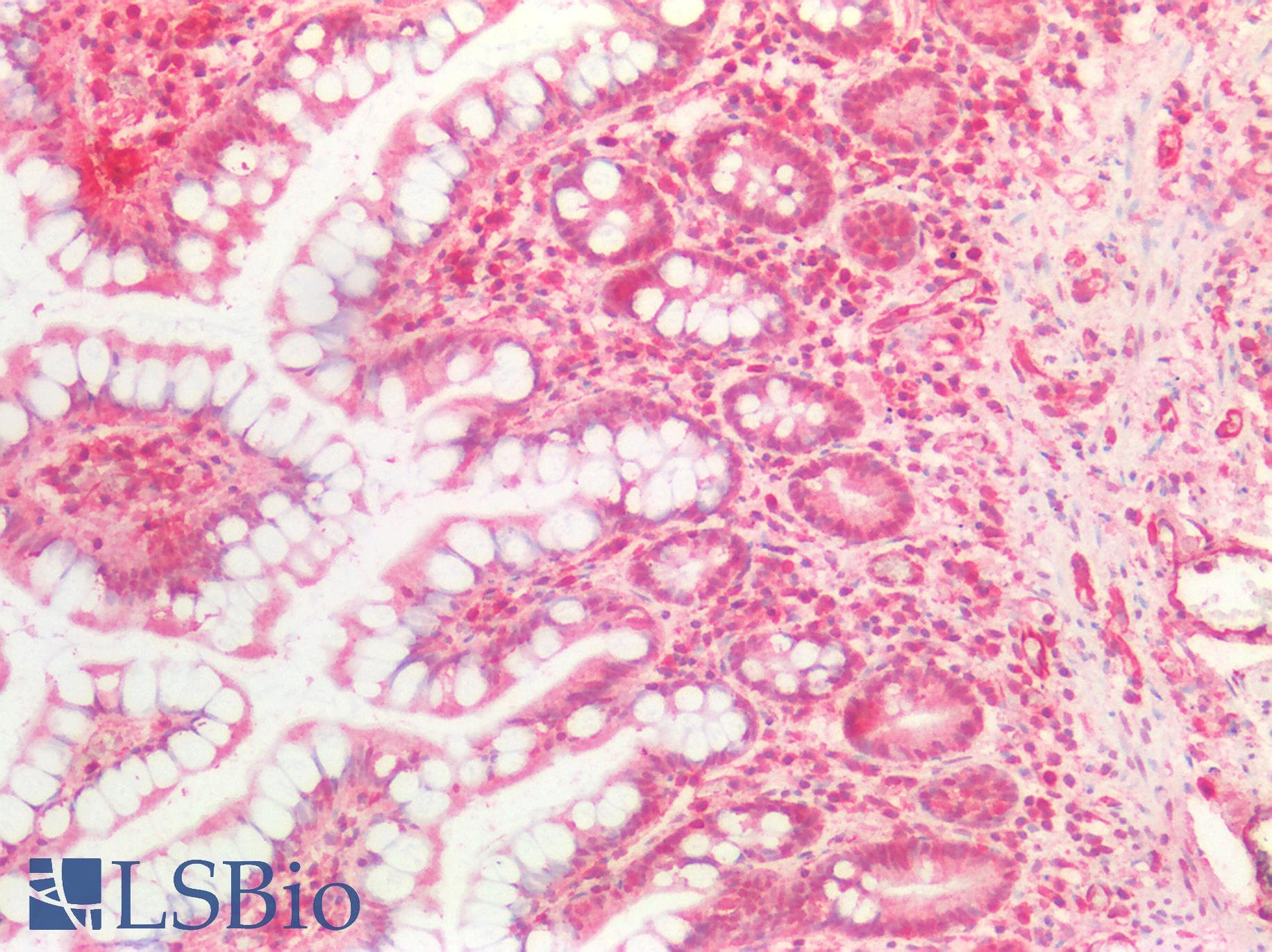 IHC-plus™ Polyclonal Goat anti-Human NOTCH1 Antibody (Amino Acids 171-182, IHC, IF)