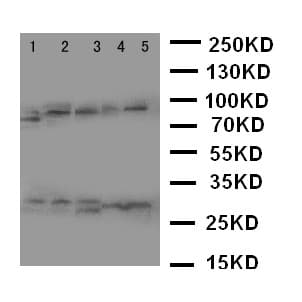 CASP14 / Caspase 14 Antibody (aa223-242)