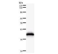 HARS Antibody (clone HARSA6)