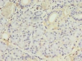 PLCD4 Antibody (aa1-762)