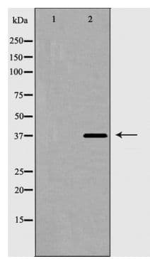 HNRNPD / AUF1 Antibody