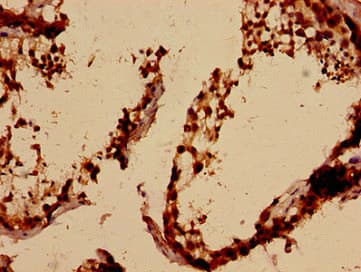 PCA1 / ALKBH3 Antibody (aa1-170)