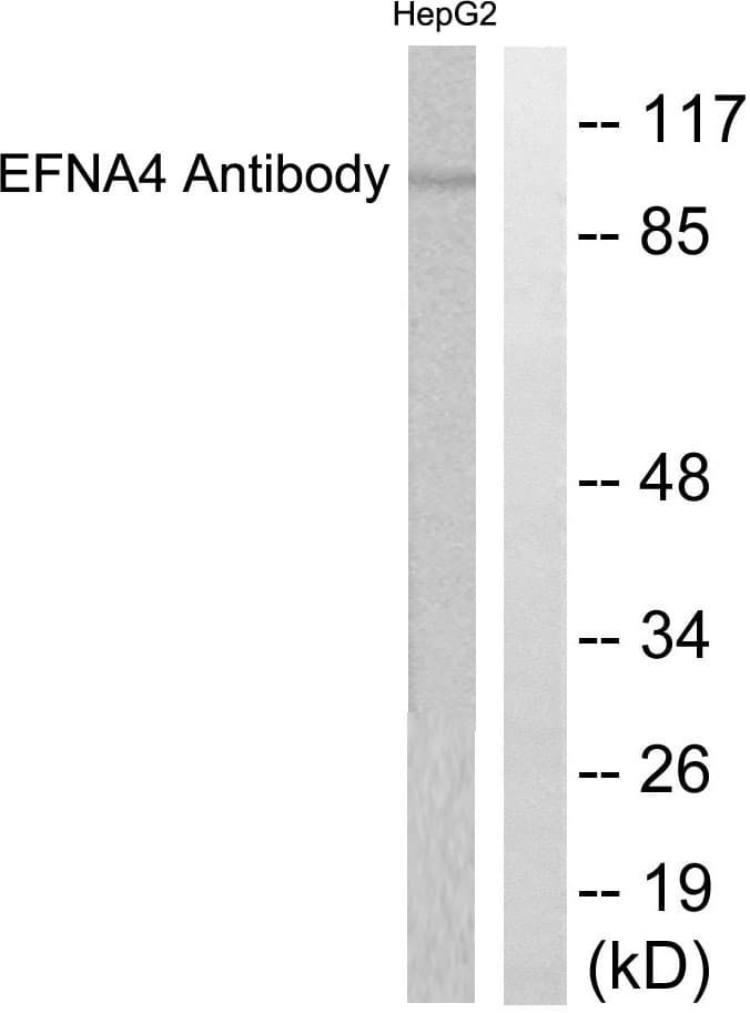 IHC-plus™ EFNA4 / Ephrin A4 Antibody (aa131-180)