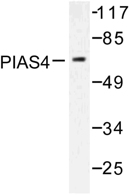 Polyclonal Rabbit anti-Human PIAS4 / PIASY Antibody (Asp488, IHC, WB)