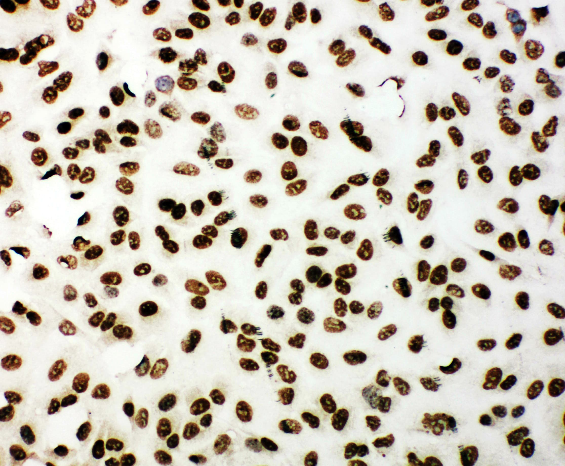 TP53BP1 / 53BP1 Antibody (aa1955-1972)