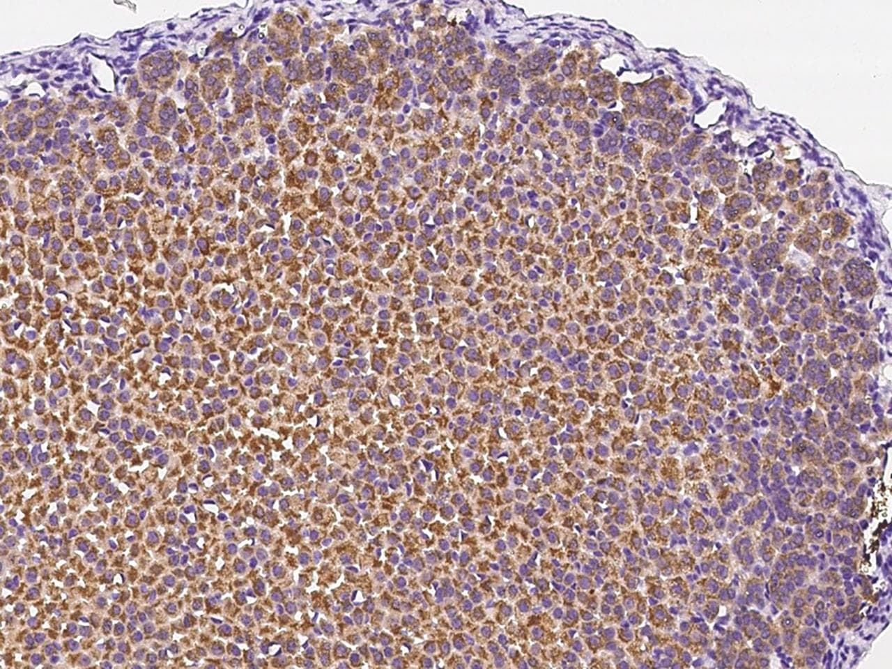 Polyclonal Rabbit anti-Mouse B4GALT6 Antibody (IHC)