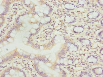 C7orf34 Antibody