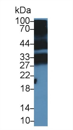 PGLYRP1 / PGRP Antibody (aa19-182)