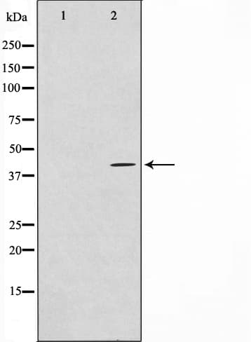 GAS41 Antibody