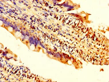 TRDMT1 / DNMT2 Antibody