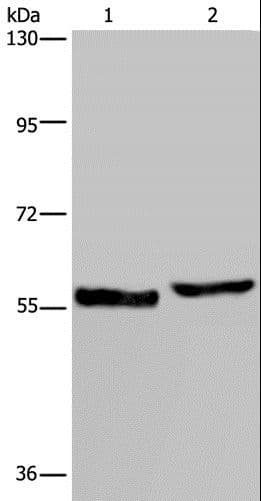 Polyclonal Rabbit anti-Human SLC1A6 / EAAT4 Antibody (IHC, WB)