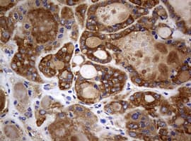 NME1 / NM23 Antibody (clone OTI22F10)