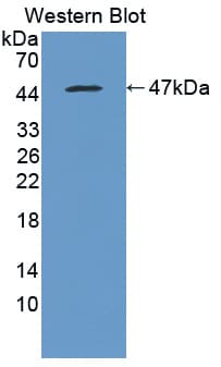 MTTP / MTP Antibody (aa28-459)