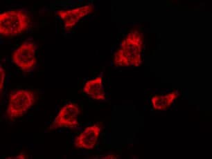 OR2T5+29 Antibody