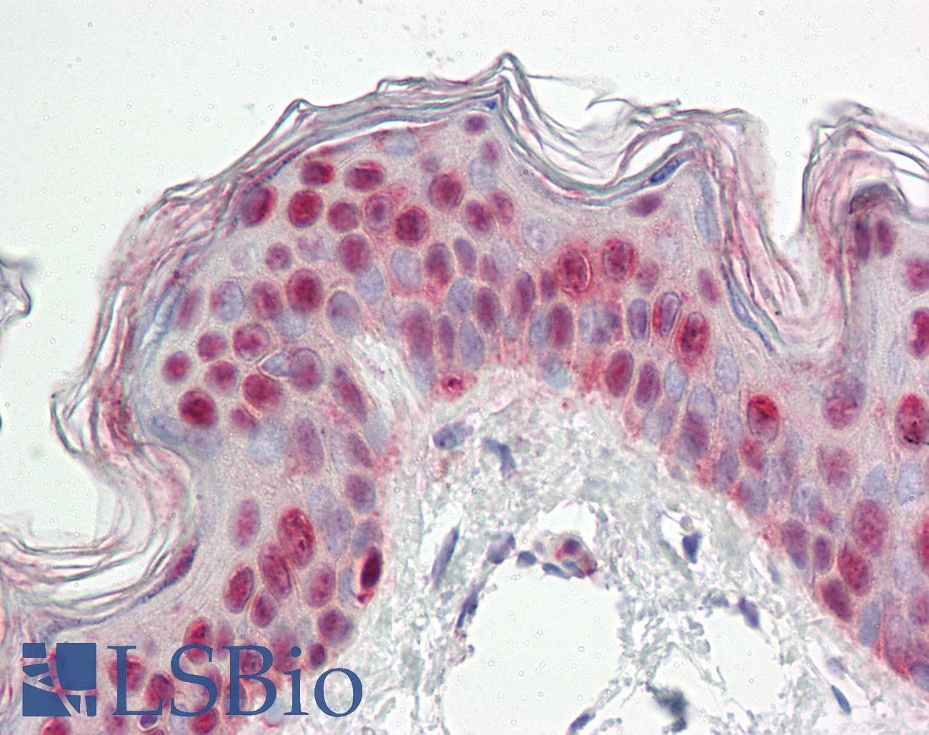 NFAT5 Antibody